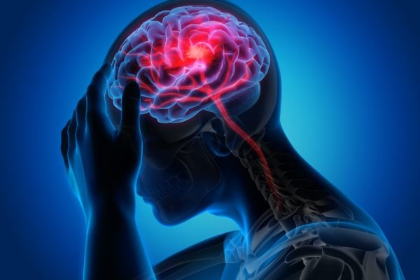 Migraine-Awareness