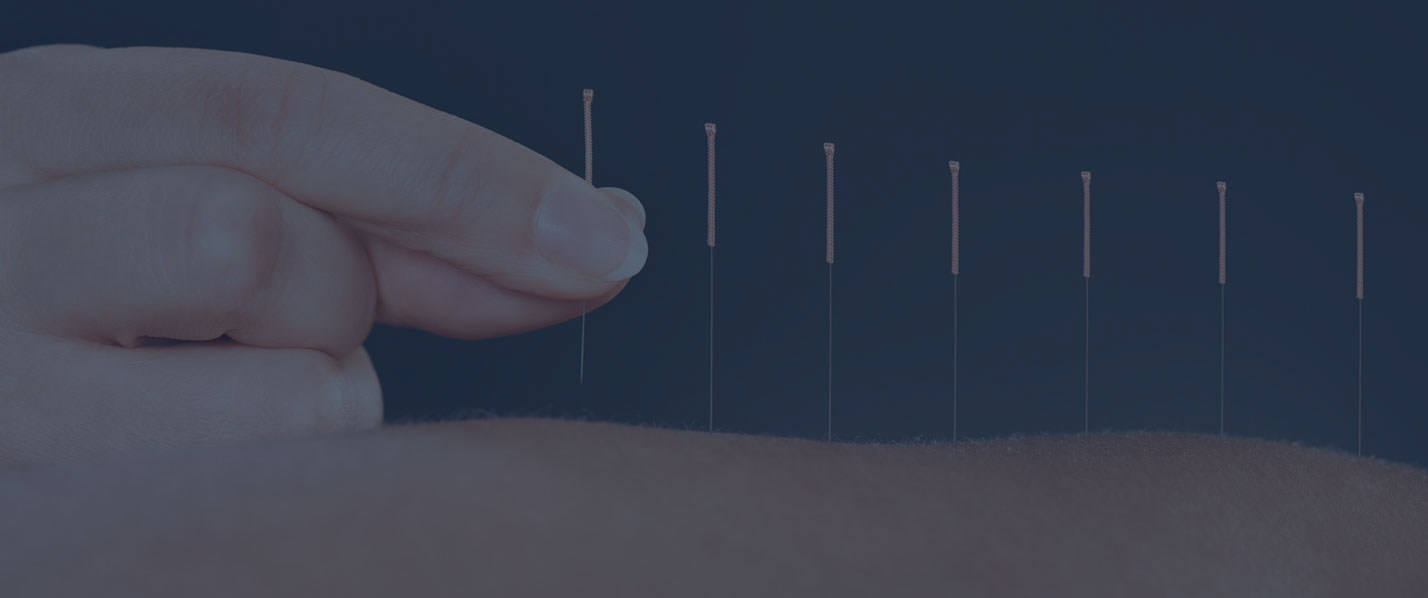 Banner image, row of acupuncture needles and a hand touching one