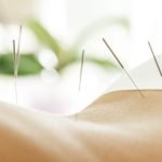 Acupuncture London