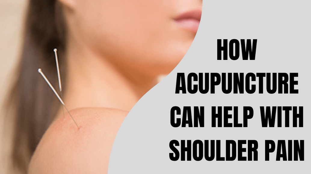 shoulder pain acupuncture