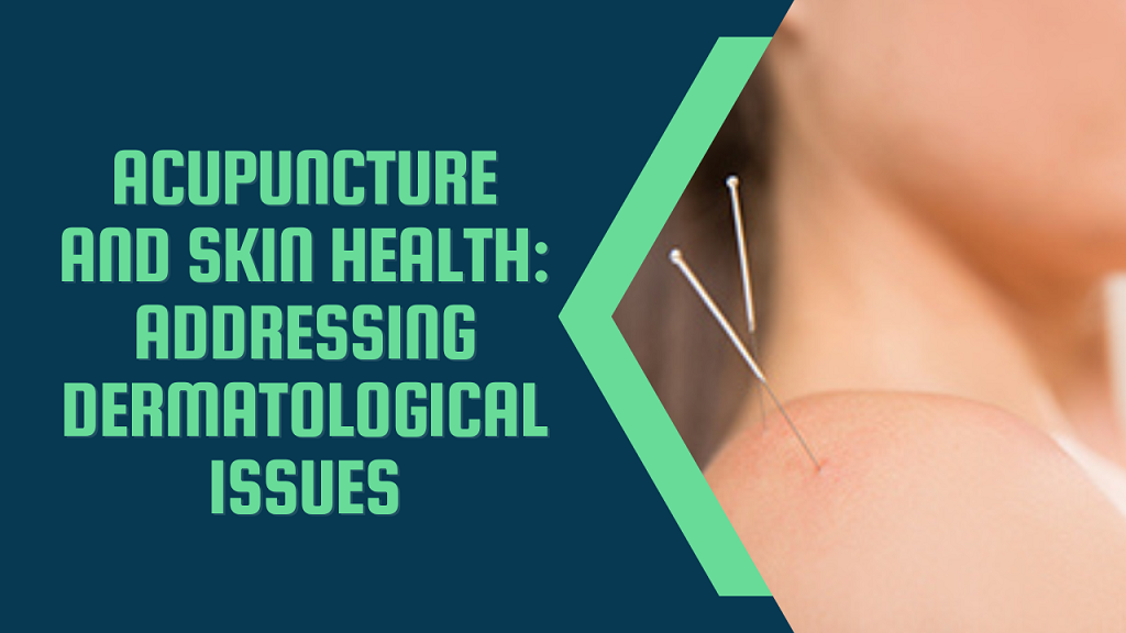 Acupuncture