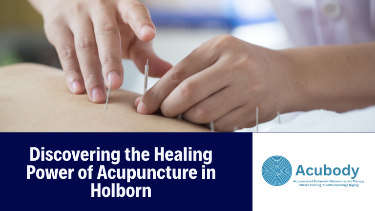 Acupuncture in Holborn