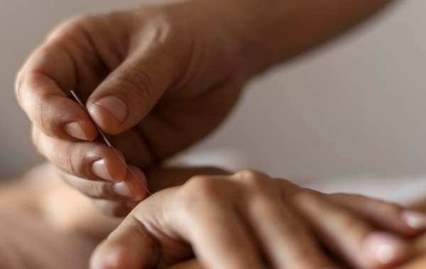 The Benefits of Acupuncture for Sports-Related Chronic Pain