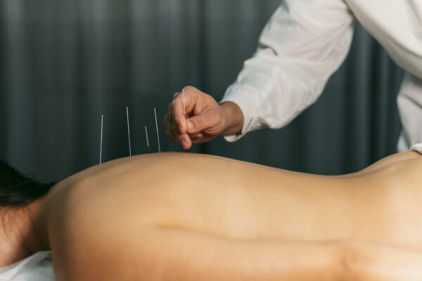 How Acupuncture Can Alleviate Pain from Long Tube Rides