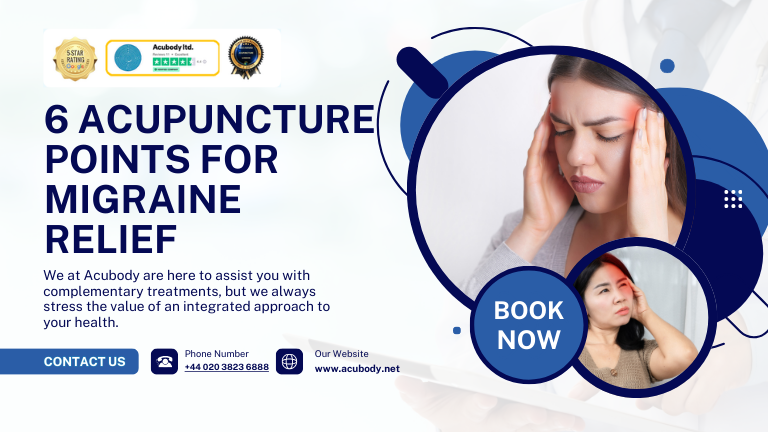 acupuncture points migraines