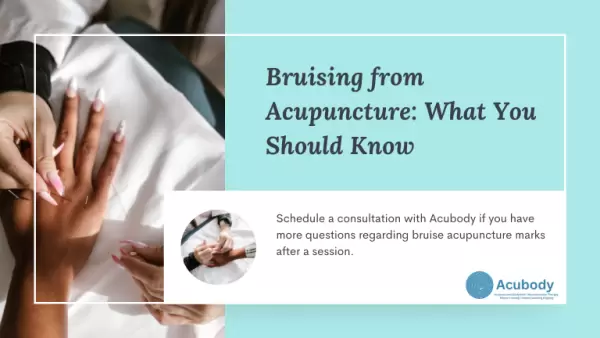 bruise acupuncture