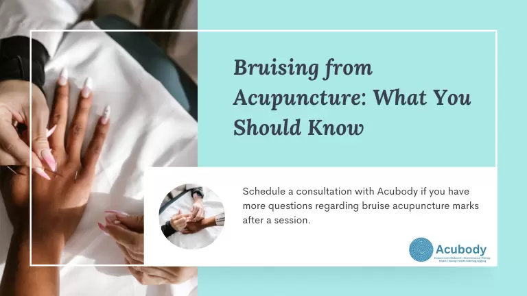 bruise acupuncture