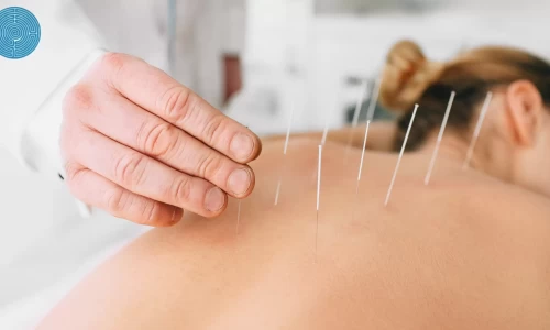 acupuncture clinic in London