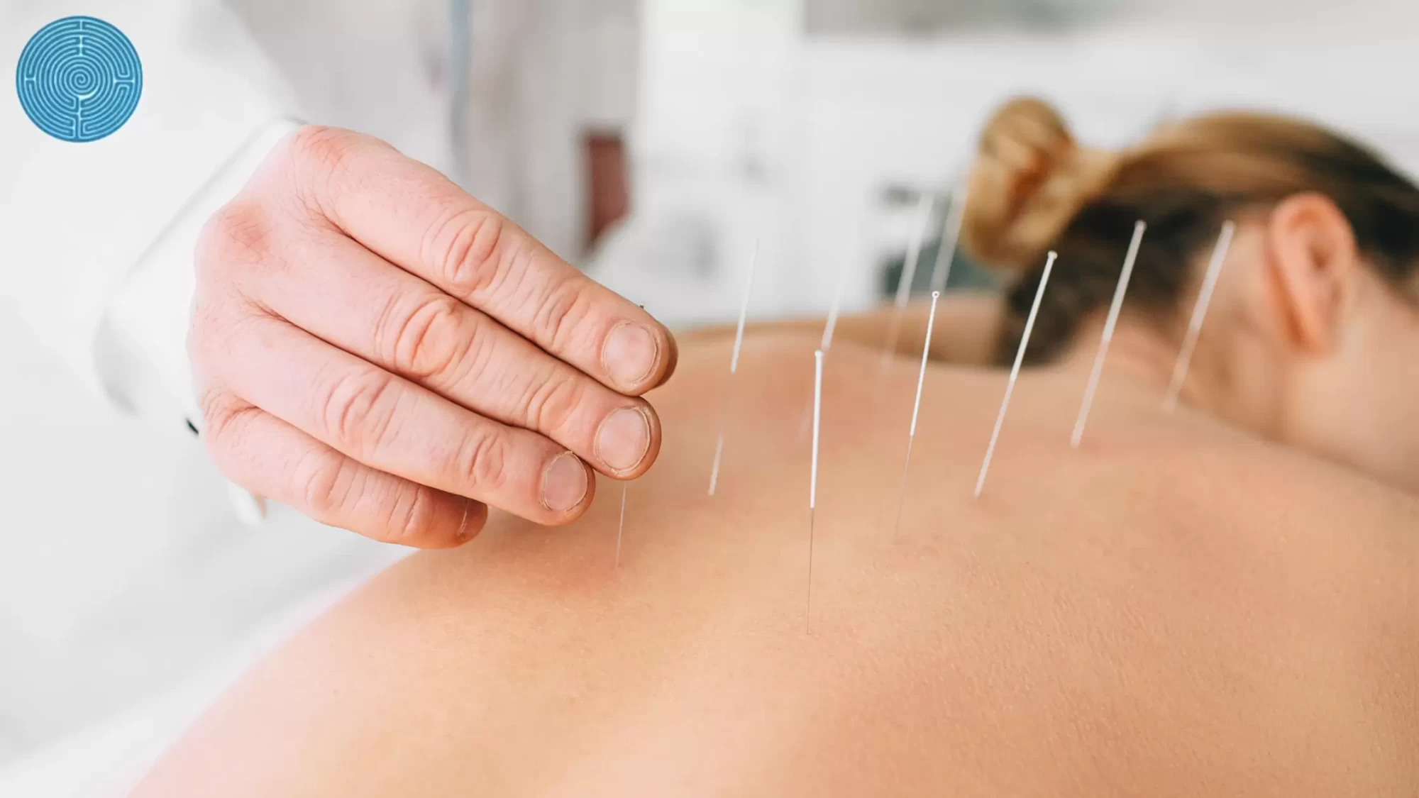 acupuncture clinic in London