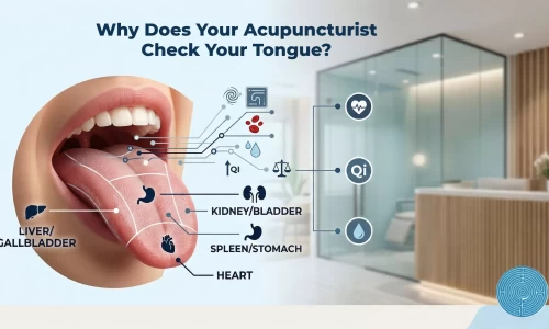 acupuncturist in London