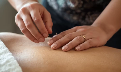 Acupuncture and Bodywork